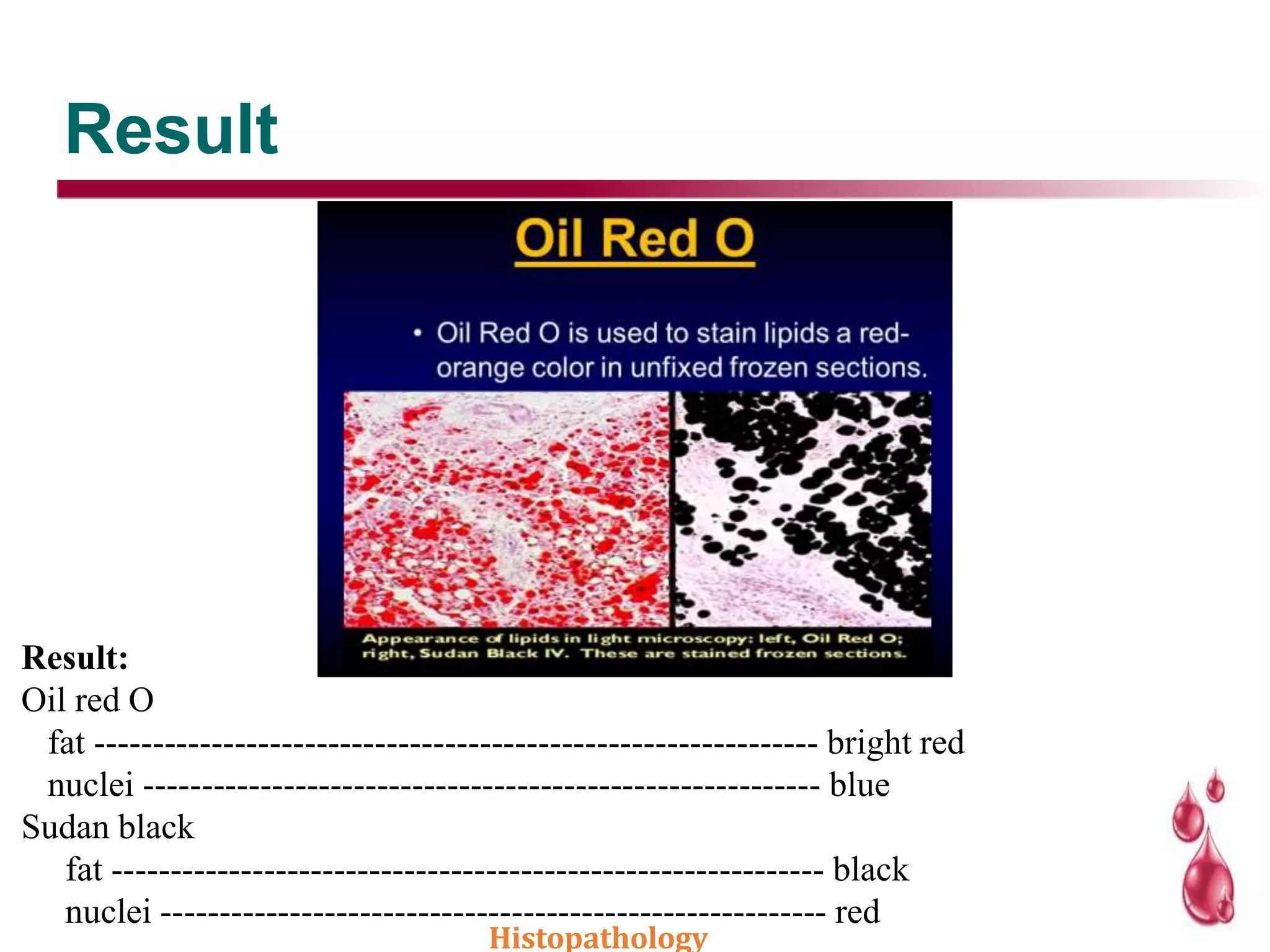 Result
Result:
Oil red O
fat -------------------------------------------------------------- bright red
nuclei ---------------------------------------------------------- blue
Sudan black
fat ------------------------------------------------------------- black
nuclei --------------------------------------------------------- red
Histopathology
 