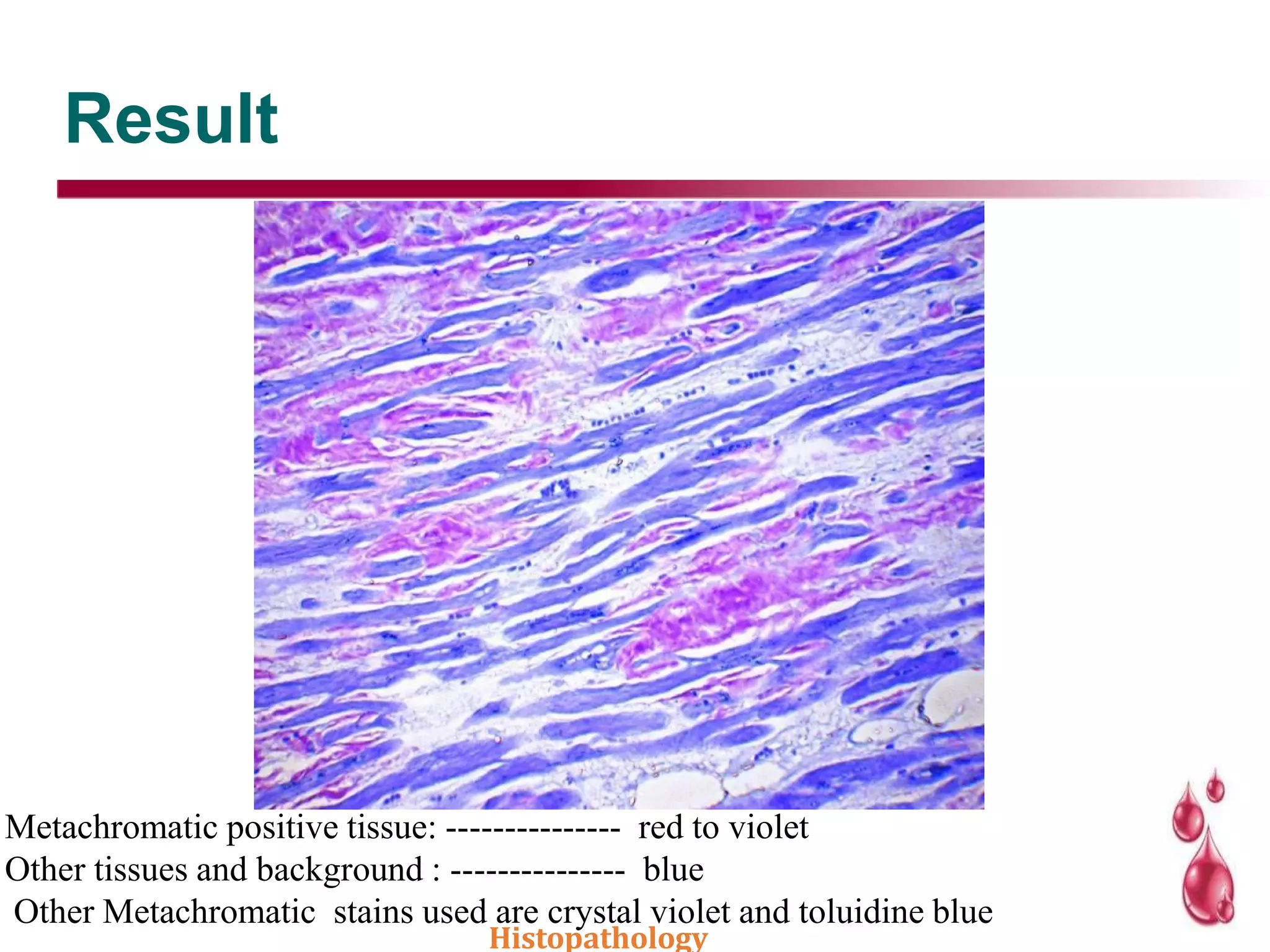 Result
Metachromatic positive tissue: --------------- red to violet
Other tissues and background : --------------- blue
Other Metachromatic stains used are crystal violet and toluidine blue
Histopathology
 