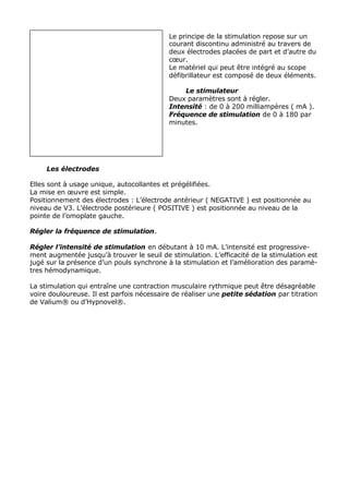 Le principe de la stimulation repose sur un
                                           courant discontinu administré au travers de
                                           deux électrodes placées de part et d’autre du
                                           cœur.
                                           Le matériel qui peut être intégré au scope
                                           défibrillateur est composé de deux éléments.

                                               Le stimulateur
                                           Deux paramètres sont à régler.
                                           Intensité : de 0 à 200 milliampères ( mA ).
                                           Fréquence de stimulation de 0 à 180 par
                                           minutes.




     Les électrodes

Elles sont à usage unique, autocollantes et prégélifiées.
La mise en œuvre est simple.
Positionnement des électrodes : L’électrode antérieur ( NEGATIVE ) est positionnée au
niveau de V3. L’électrode postérieure ( POSITIVE ) est positionnée au niveau de la
pointe de l’omoplate gauche.

Régler la fréquence de stimulation.

Régler l’intensité de stimulation en débutant à 10 mA. L’intensité est progressive-
ment augmentée jusqu’à trouver le seuil de stimulation. L’efficacité de la stimulation est
jugé sur la présence d’un pouls synchrone à la stimulation et l’amélioration des paramè-
tres hémodynamique.

La stimulation qui entraîne une contraction musculaire rythmique peut être désagréable
voire douloureuse. Il est parfois nécessaire de réaliser une petite sédation par titration
de Valium® ou d’Hypnovel®.
 