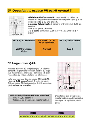 3° Question : L’espace PR est-il normal ?

                       Définition de l’espace PR : Se mesure du début de
                       l’onde P à la première déflexion du complexe QRS que se
                       soit une onde Q ou une onde R.
                       L’espace PR normal est compris entre 0,12 et 0,20 se-
                       condes
                       Soit 2 à 5 petits carreaux.
                       3 à 5 petits carreaux ( 0,04 x 3 = 0,12 ) ( 0,04 x 5 =
                       0,20 )


     PR < 0, 12 secondes          PR entre 0,12 et      PR > 0,20 secondes
                                   0,20 secondes


         Wolf Parkinson                 Normal                  BAV I
             White




3° Largeur des QRS.

Mesurée du début du complexe QRS ( A ) corres-
pondant à la première déflexion positive ou néga-
tive du complexe. A la fin du complexe ( B ) cor-
respondant au retour à la ligne iso-électrique.

La largeur normale d’un complexe QRS est infé-
rieure à 0,12 secondes soit 3 petits carreaux.
Si le complexe QRS est supérieur à 0,12 secondes,
c’est un bloc de branche.




Caractéristiques des blocs de branches :            L’existence des troubles de
•   QRS > 0,12 secondes.                            repolarisation rend impossible
•   Présence de troubles de repolarisation          l’analyse de signes ischémi-
                                                    ques.




                         BBD                           BBG
             Aspect onde « M » en V1,V2 Aspect onde « M » en V5,V6
 