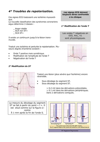 4° Troubles de repolarisation.                               Les signes ECG doivent
                                                            toujours êtres confrontés
Ces signes ECG traduisent une ischémie myocardi-                   à la clinique .
que.
La nouvelle classification des syndromes coronariens
aigus détermine 3 classes :
                                                           1° Modification de l’onde T
     _ Angor stable
     _ SCA non ST+
     _ SCA ST+                                              Les ondes T négatives en
                                                                  DIII, AVL, V1
Il existe un continuum jusqu’à la lésion trans-               sont physiologiques.
murale.


Traduit une ischémie et perturbe la repolarisation. Plu-
sieurs degrés d’ischémie existent :

•    Onde T positive mais symétrique.
•    Modification de l’amplitude de l’onde T
•    Négativation de l’onde T



2° Modification du ST



                               Traduit une lésion (plus sévère que l’ischémie) encore
                               réversible.

                               •    Sous décalage du segment ST.
                               •    Sous décalage du segment ST.

                                         > 0.2 mV dans les dérivations précordiales.
                                         > 0.1 mV dans les dérivations périphériques.
                                         Dans 2 dérivations contiguës.




La mesure du décalage du segment
ST se fait à partir du point « J ». Il
 est situé comme sur la figure ci-
               contre
  À 1 mm après la fin de l’onde S.
 