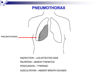 Lecture Respiratory system.pptx