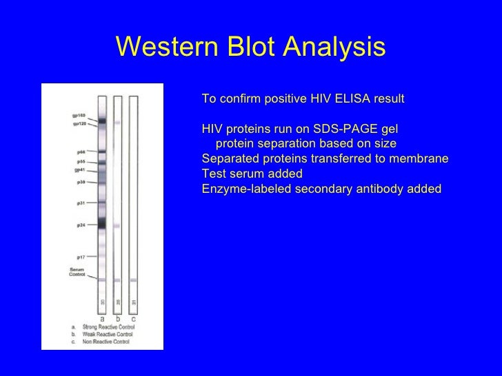western blot test and elisa test