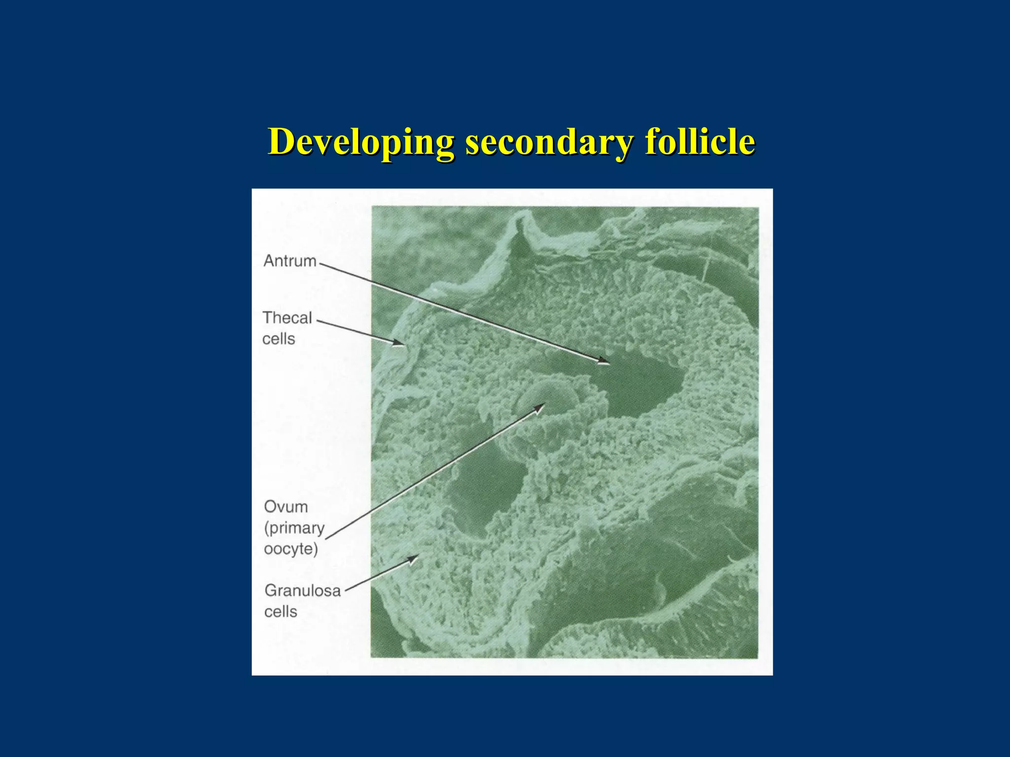 Developing secondary follicleDeveloping secondary follicle
 