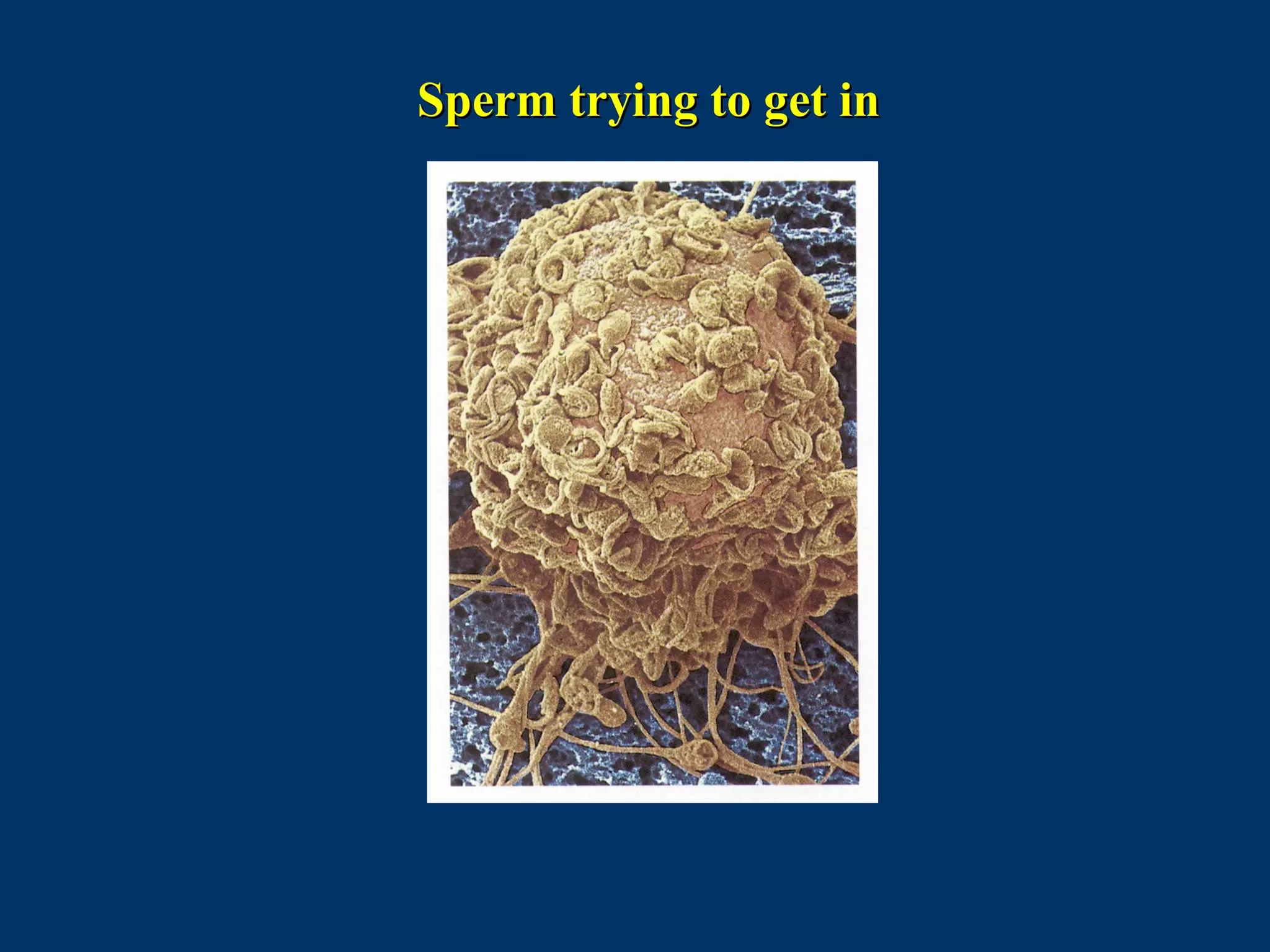 Sperm trying to get inSperm trying to get in
 