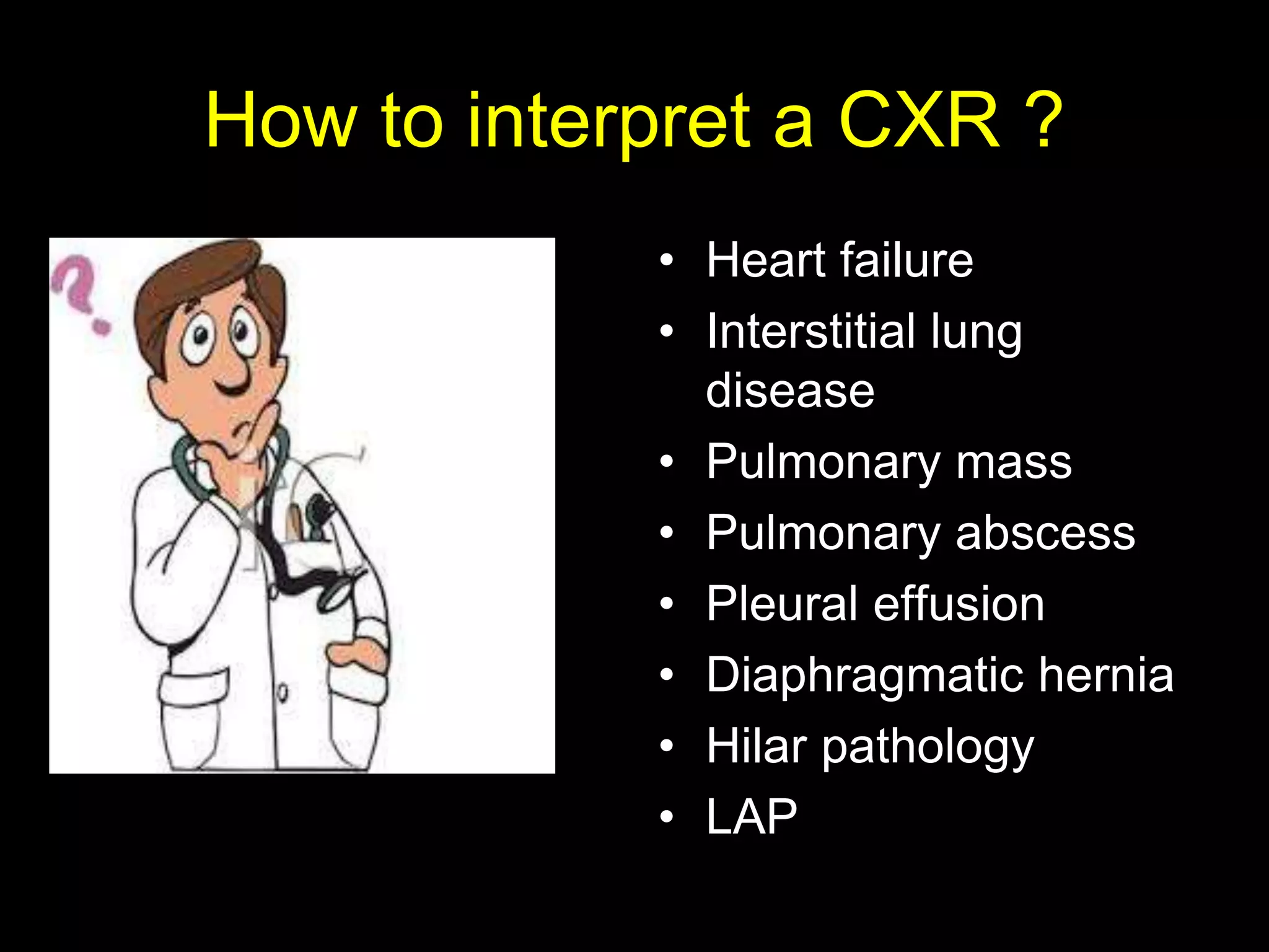 How to interpret a CXR ?
• Heart failure
• Interstitial lung
disease
• Pulmonary mass
• Pulmonary abscess
• Pleural effusion
• Diaphragmatic hernia
• Hilar pathology
• LAP
 