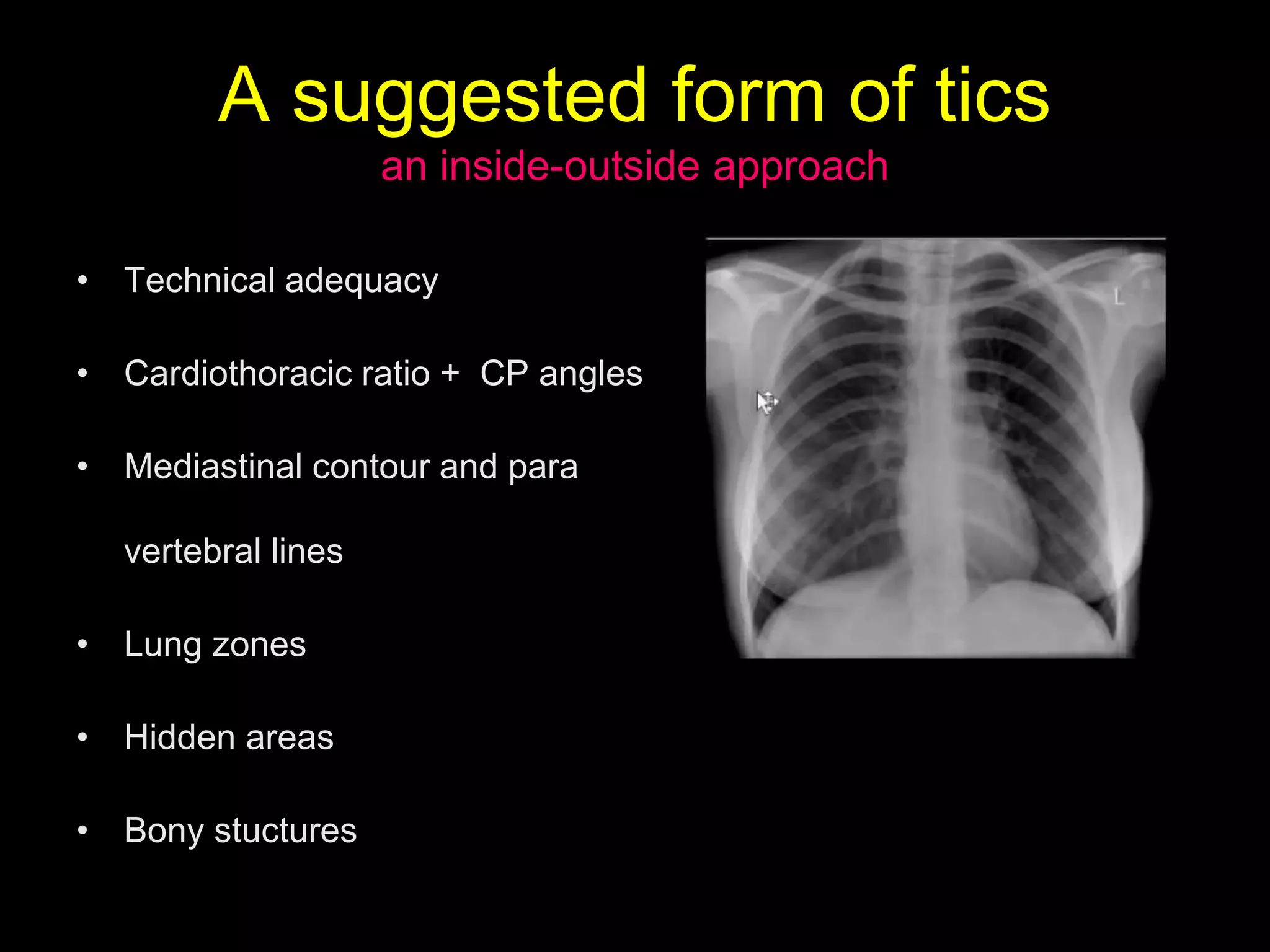 A suggested form of tics
an inside-outside approach
• Technical adequacy
• Cardiothoracic ratio + CP angles
• Mediastinal contour and para
vertebral lines
• Lung zones
• Hidden areas
• Bony stuctures
 