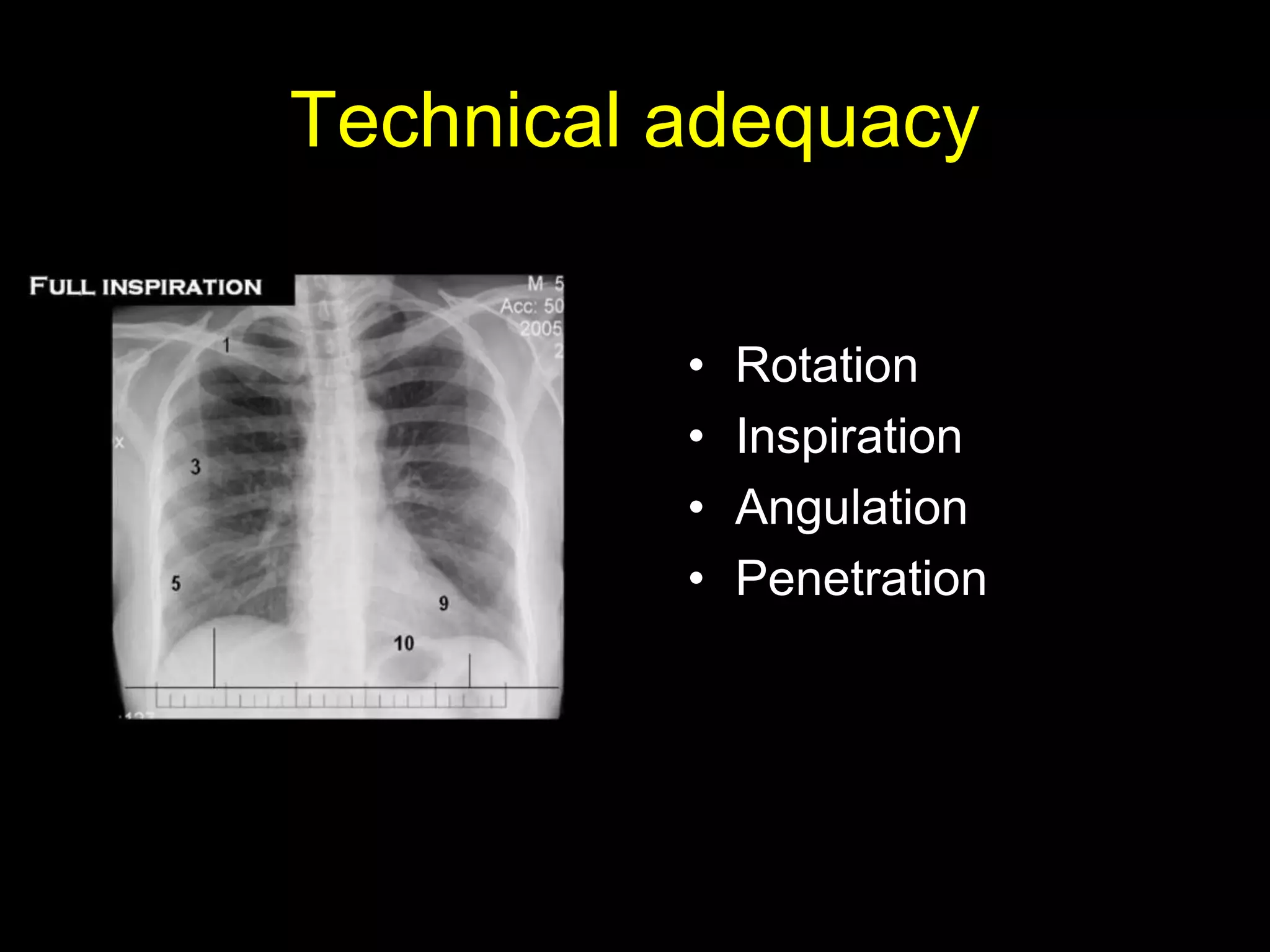 Technical adequacy
• Rotation
• Inspiration
• Angulation
• Penetration
 