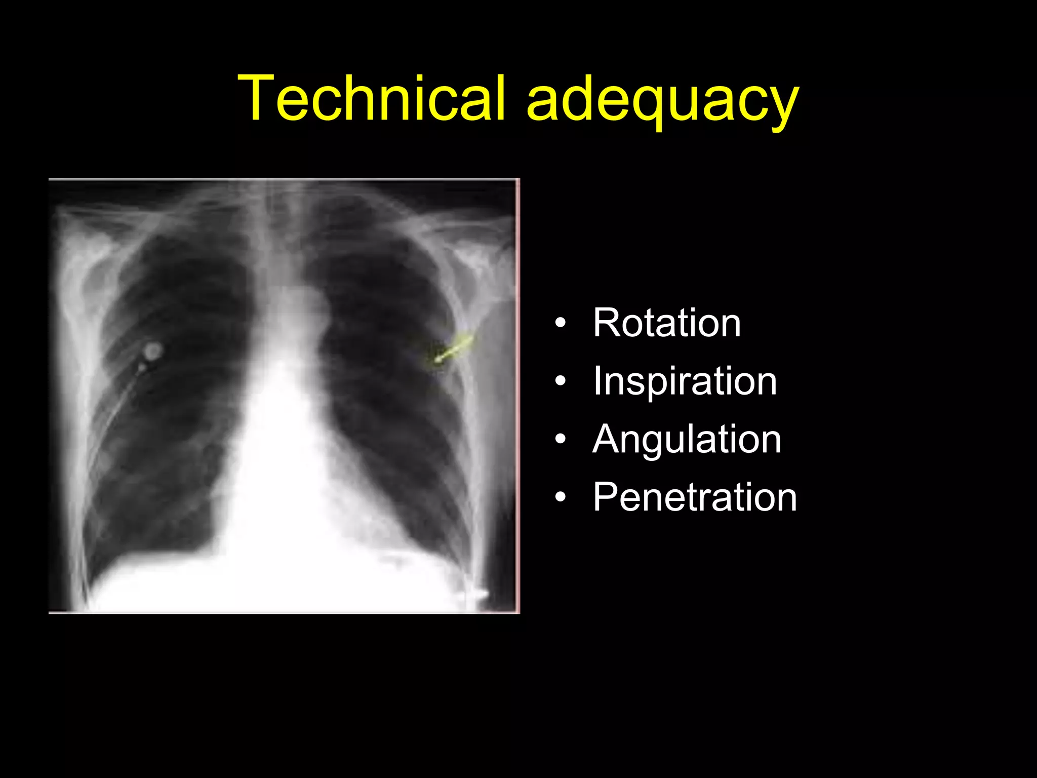 Technical adequacy
• Rotation
• Inspiration
• Angulation
• Penetration
 