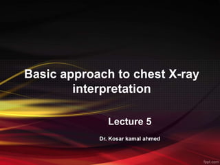 Basic approach to chest X-ray
interpretation
Lecture 5
Dr. Kosar kamal ahmed
 