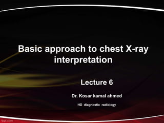Basic approach to chest X-ray
interpretation
Lecture 6
Dr. Kosar kamal ahmed
HD diagnostic radiology
 