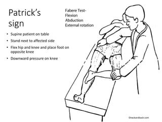 Patrick's Sign Sacroiliac Joint fusion | PPTX