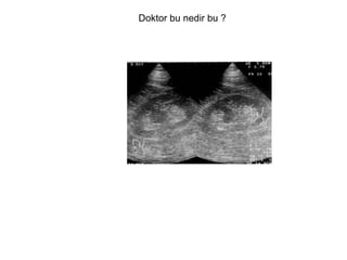 Doktor bu nedir bu ? 