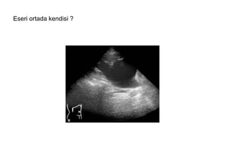 Eseri ortada kendisi ? 