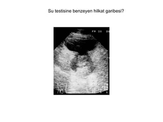 Su testisine benzeyen hilkat garibesi? 