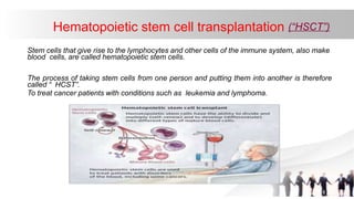 Hematopoietic stem cell transplantation (“HSCT”)
Stem cells that give rise to the lymphocytes and other cells of the immune system, also make
blood cells, are called hematopoietic stem cells.
The process of taking stem cells from one person and putting them into another is therefore
called “ HCST”.
To treat cancer patients with conditions such as leukemia and lymphoma.
 