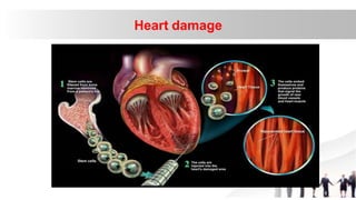 Heart damage
 