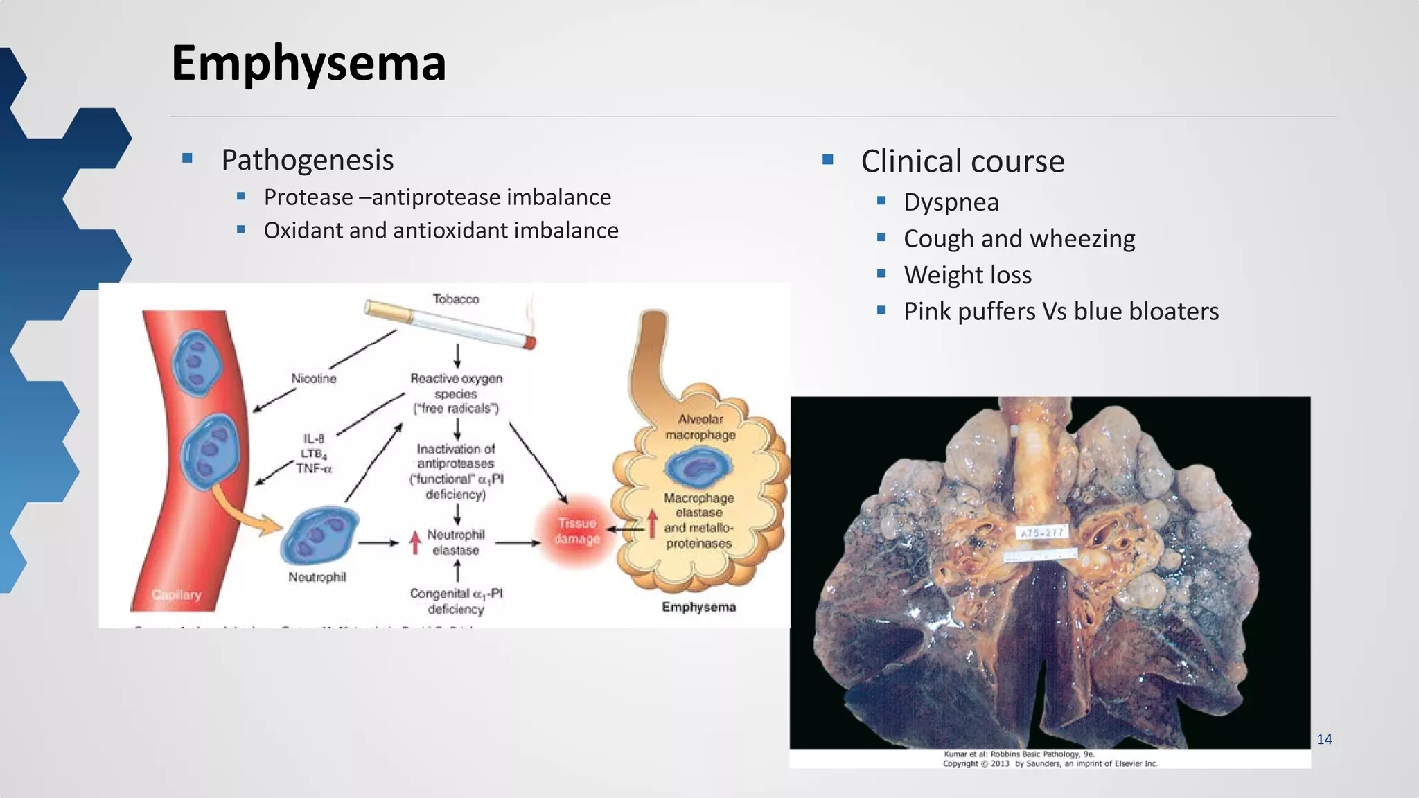14
Emphysema
 Pathogenesis
 Protease –antiprotease imbalance
 Oxidant and antioxidant imbalance
 Clinical course
 Dyspnea
 Cough and wheezing
 Weight loss
 Pink puffers Vs blue bloaters
 