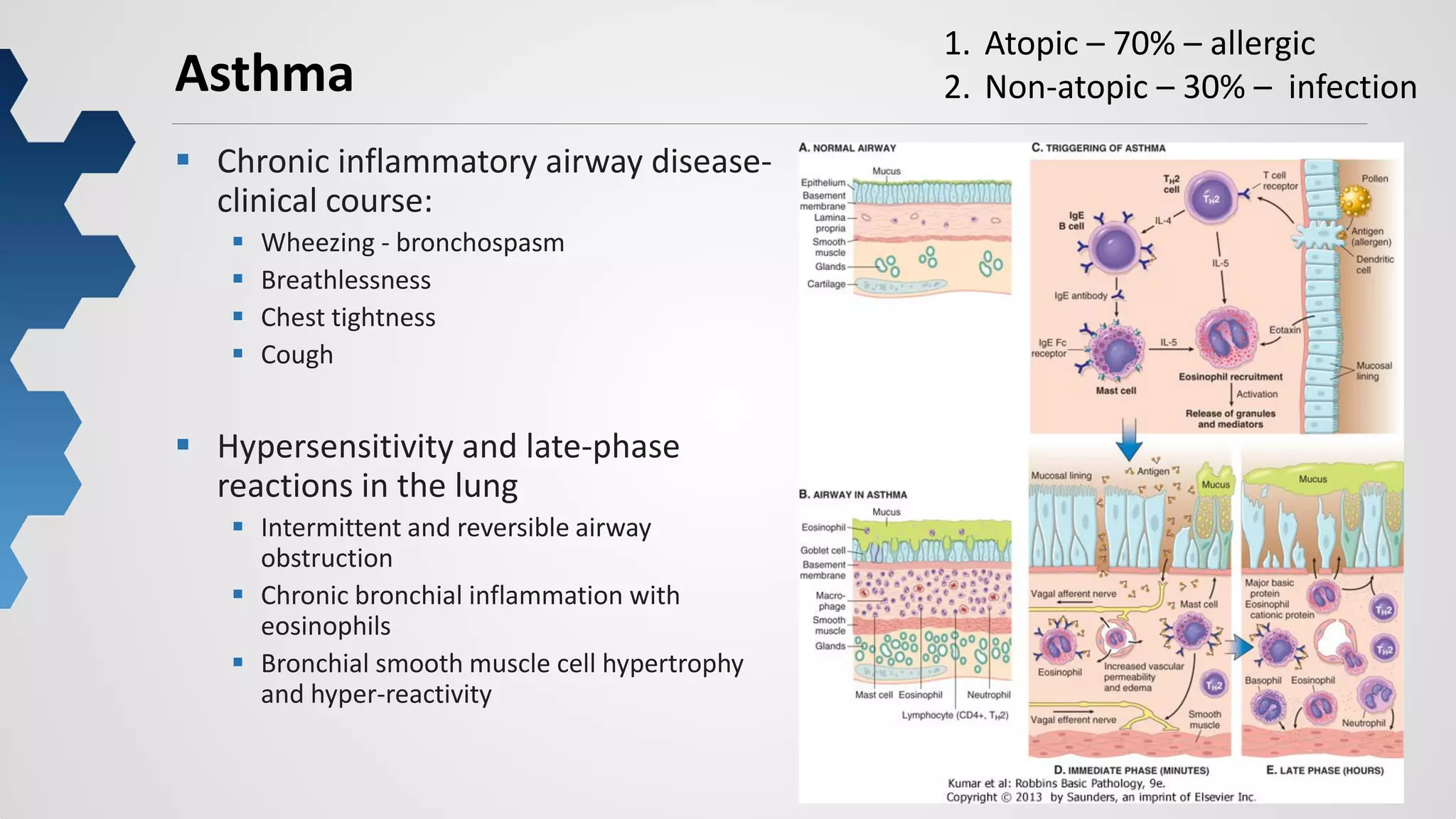 16
Asthma
 Chronic inflammatory airway disease-
clinical course:
 Wheezing - bronchospasm
 Breathlessness
 Chest tightness
 Cough
 Hypersensitivity and late-phase
reactions in the lung
 Intermittent and reversible airway
obstruction
 Chronic bronchial inflammation with
eosinophils
 Bronchial smooth muscle cell hypertrophy
and hyper-reactivity
1. Atopic – 70% – allergic
2. Non-atopic – 30% – infection
 