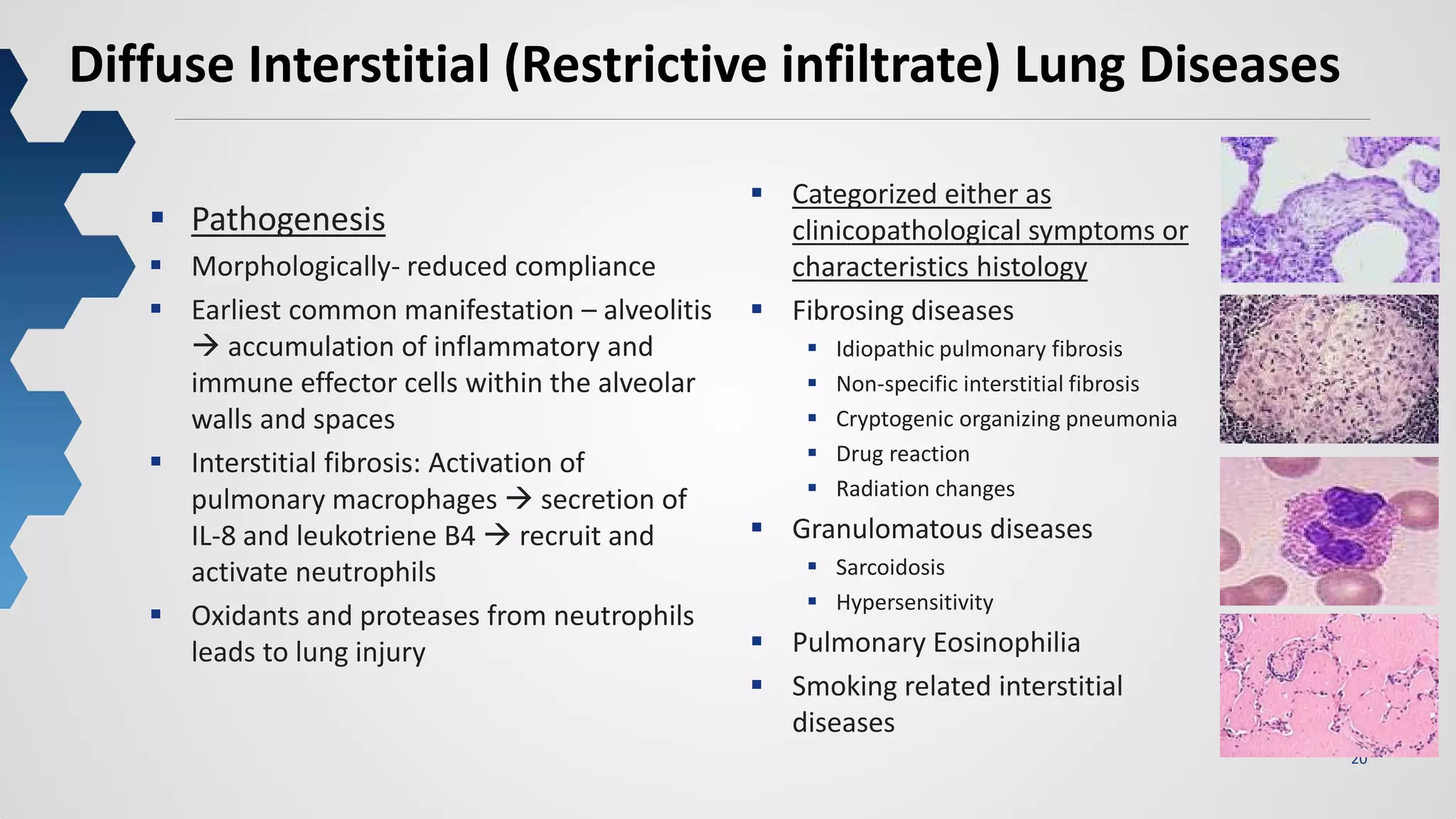 20
Diffuse Interstitial (Restrictive infiltrate) Lung Diseases
 Categorized either as
clinicopathological symptoms or
characteristics histology
 Fibrosing diseases
 Idiopathic pulmonary fibrosis
 Non-specific interstitial fibrosis
 Cryptogenic organizing pneumonia
 Drug reaction
 Radiation changes
 Granulomatous diseases
 Sarcoidosis
 Hypersensitivity
 Pulmonary Eosinophilia
 Smoking related interstitial
diseases
 Pathogenesis
 Morphologically- reduced compliance
 Earliest common manifestation – alveolitis
 accumulation of inflammatory and
immune effector cells within the alveolar
walls and spaces
 Interstitial fibrosis: Activation of
pulmonary macrophages  secretion of
IL-8 and leukotriene B4  recruit and
activate neutrophils
 Oxidants and proteases from neutrophils
leads to lung injury
 