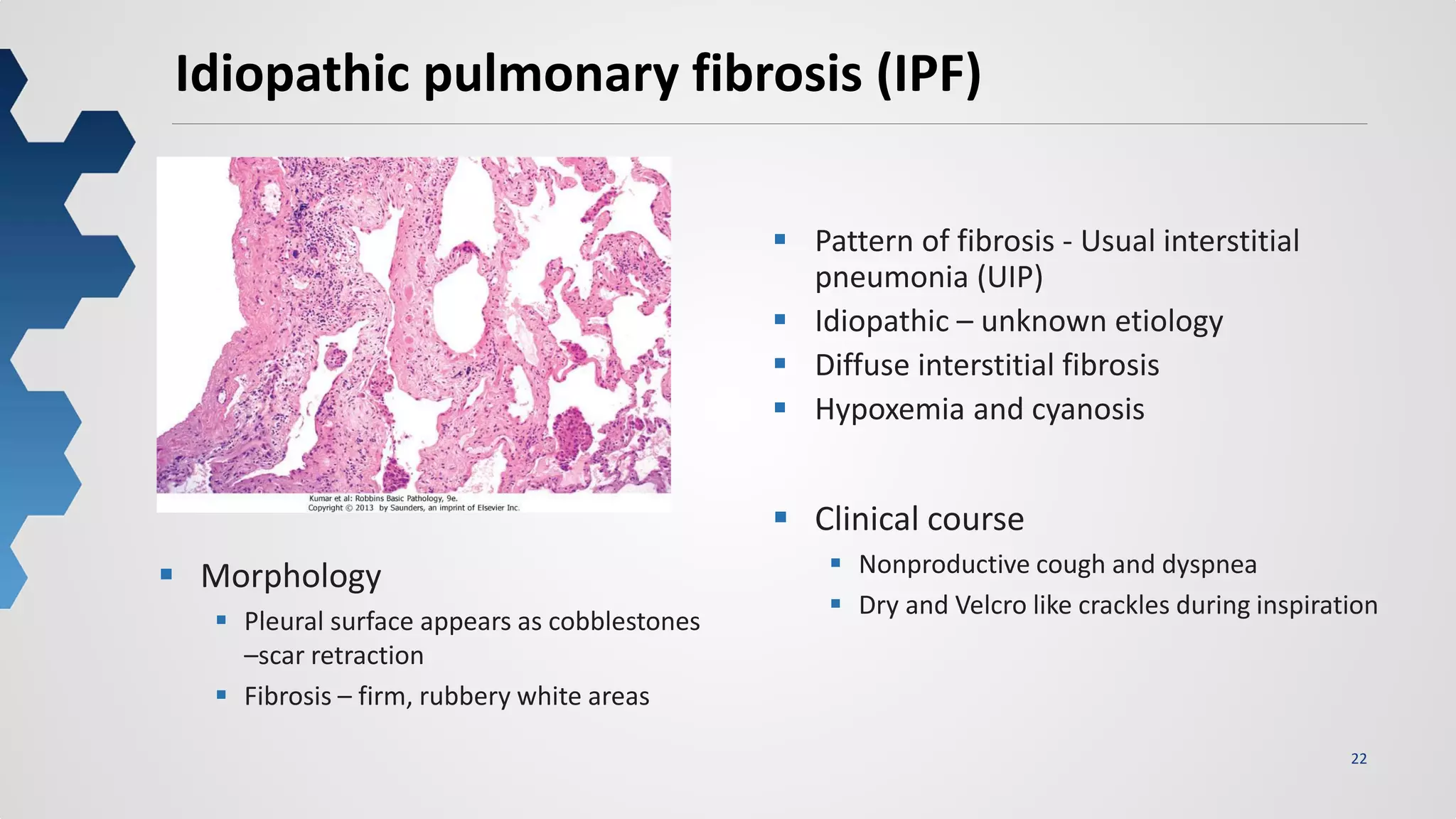 22
Idiopathic pulmonary fibrosis (IPF)
 Pattern of fibrosis - Usual interstitial
pneumonia (UIP)
 Idiopathic – unknown etiology
 Diffuse interstitial fibrosis
 Hypoxemia and cyanosis
 Morphology
 Pleural surface appears as cobblestones
–scar retraction
 Fibrosis – firm, rubbery white areas
 Clinical course
 Nonproductive cough and dyspnea
 Dry and Velcro like crackles during inspiration
 