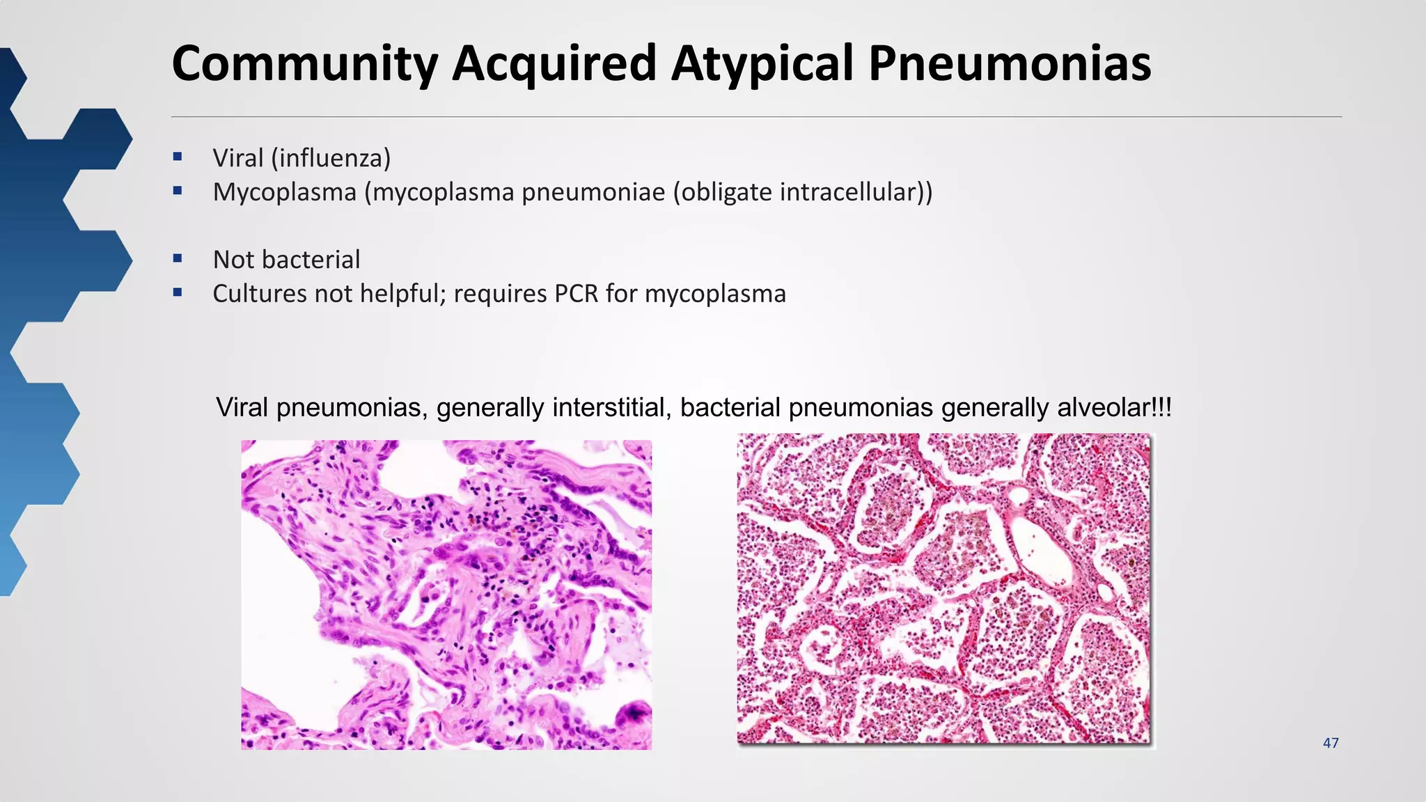 47
Community Acquired Atypical Pneumonias
 Viral (influenza)
 Mycoplasma (mycoplasma pneumoniae (obligate intracellular))
 Not bacterial
 Cultures not helpful; requires PCR for mycoplasma
Viral pneumonias, generally interstitial, bacterial pneumonias generally alveolar!!!
 