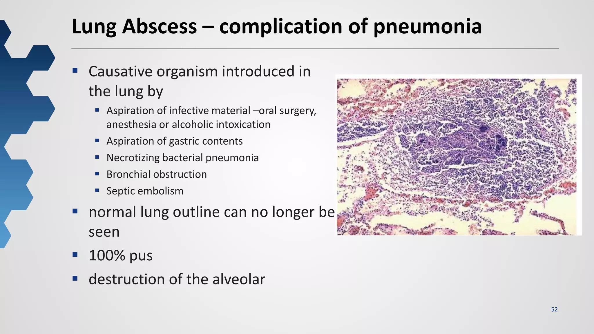 52
Lung Abscess – complication of pneumonia
 Causative organism introduced in
the lung by
 Aspiration of infective material –oral surgery,
anesthesia or alcoholic intoxication
 Aspiration of gastric contents
 Necrotizing bacterial pneumonia
 Bronchial obstruction
 Septic embolism
 normal lung outline can no longer be
seen
 100% pus
 destruction of the alveolar
 