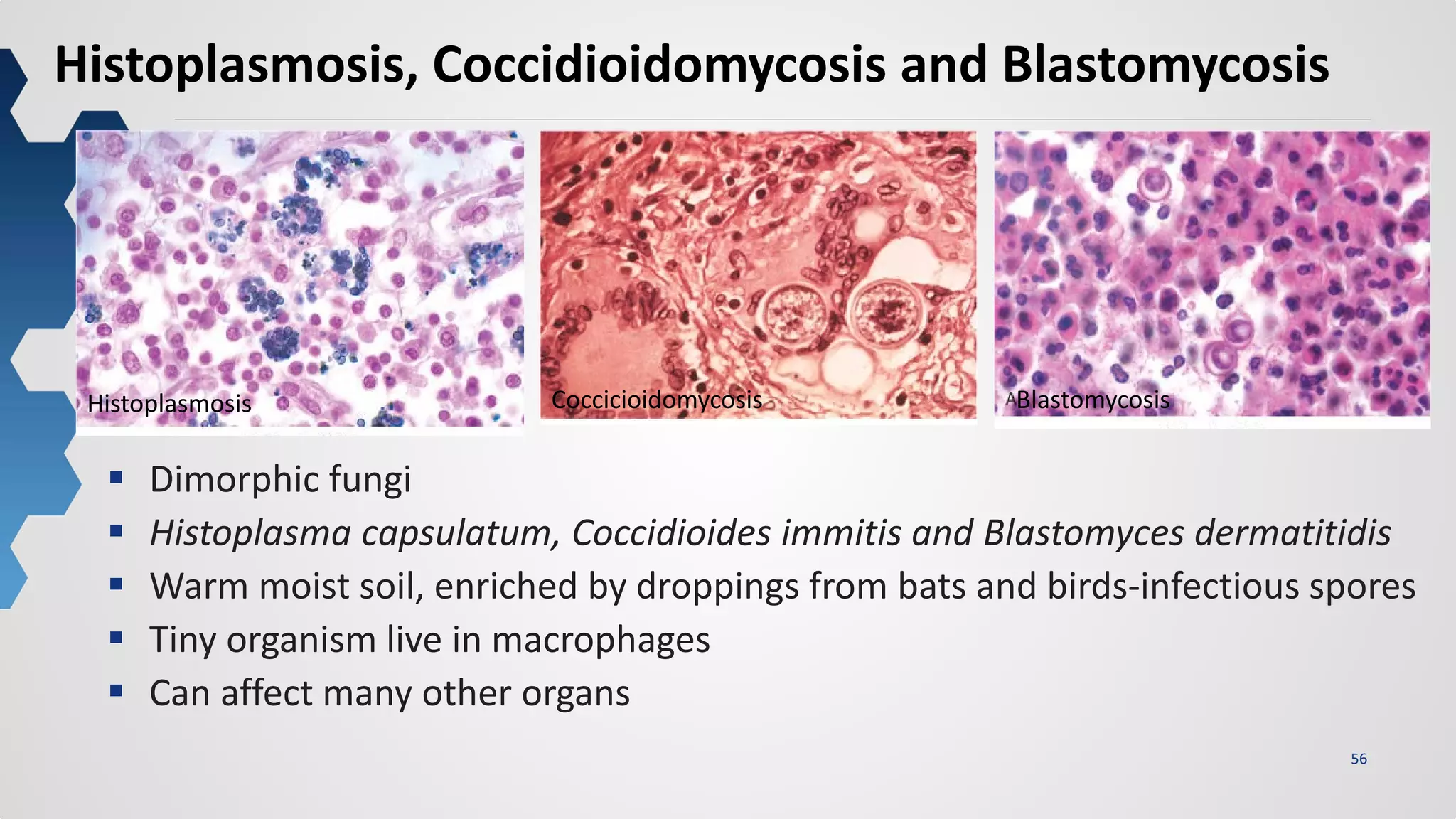 56
Histoplasmosis, Coccidioidomycosis and Blastomycosis
 Dimorphic fungi
 Histoplasma capsulatum, Coccidioides immitis and Blastomyces dermatitidis
 Warm moist soil, enriched by droppings from bats and birds-infectious spores
 Tiny organism live in macrophages
 Can affect many other organs
Histoplasmosis Coccicioidomycosis Blastomycosis
 