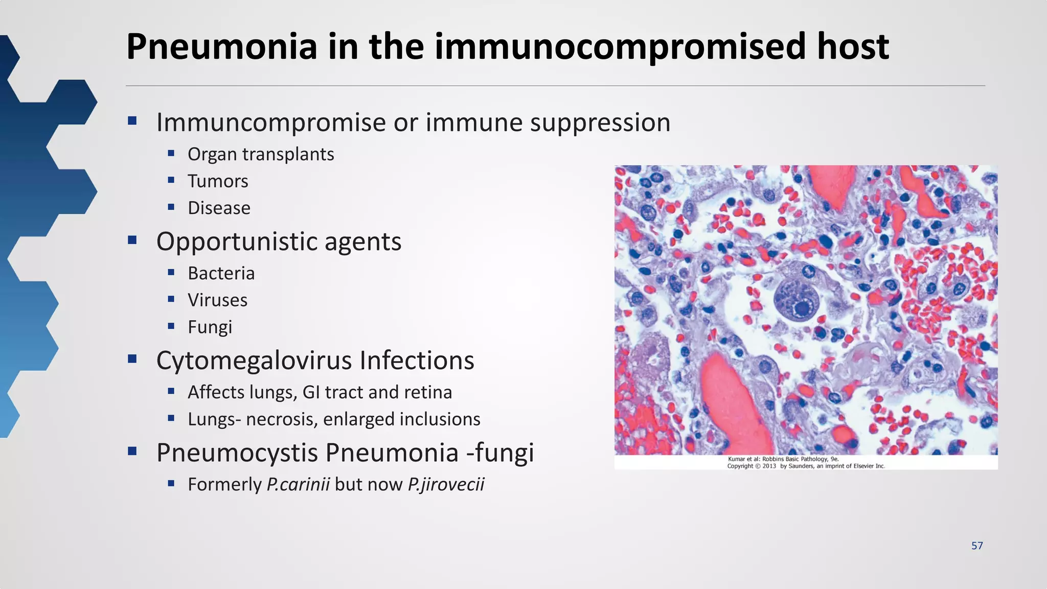 57
Pneumonia in the immunocompromised host
 Immuncompromise or immune suppression
 Organ transplants
 Tumors
 Disease
 Opportunistic agents
 Bacteria
 Viruses
 Fungi
 Cytomegalovirus Infections
 Affects lungs, GI tract and retina
 Lungs- necrosis, enlarged inclusions
 Pneumocystis Pneumonia -fungi
 Formerly P.carinii but now P.jirovecii
 