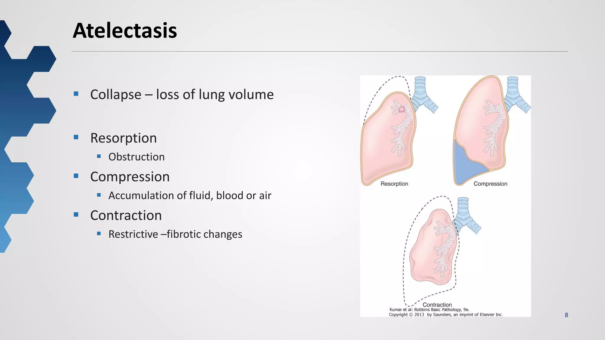 8
Atelectasis
 Collapse – loss of lung volume
 Resorption
 Obstruction
 Compression
 Accumulation of fluid, blood or air
 Contraction
 Restrictive –fibrotic changes
 