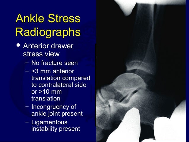 Lecture Trauma Ankle Tendon