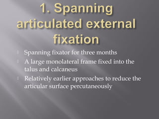  Spanning fixator for three months 
 A large monolateral frame fixed into the 
talus and calcaneus 
 Relatively earlier approaches to reduce the 
articular surface percutaneously 
 