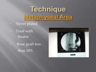  Never plated 
 Treat with 
fixator 
 Bone graft less 
than 10% 
 