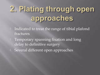  Indicated to treat the range of tibial plafond 
fractures 
 Temporary spanning fixation and long 
delay to definitive surgery 
 Several different open approaches 
 