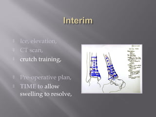  Ice, elevation, 
 CT scan, 
 crutch training, 
 Pre-operative plan, 
 TIME to allow 
swelling to resolve, 
 