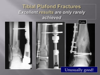 2 yrs. 
Unusually good! 
 