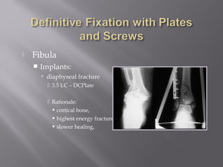  Fibula 
 Implants: 
 diaphyseal fracture 
 3.5 LC – DCPlate 
 Rationale: 
 cortical bone, 
 highest energy fractures, 
 slower healing, 
 