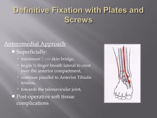 Anteromedial Approach 
 Superficially: 
 minimum 7 cm skin bridge, 
 begin ½ finger breath lateral to crest 
over the anterior compartment, 
 continue parallel to Anterior Tibialis 
tendon, 
 towards the talonavicular joint, 
 Post-operative soft tissue 
complications 
 