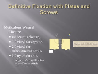 Meticulous Wound 
Closure 
 meticulous closure, 
 1-0 vicryl for capsule, 
 2-0 vicryl for 
subcutaneous tissue, 
 3-0 nylon for skin, 
 Allgower’s modification 
of the Donati stitch, 
Allgöwer stitch modified by 
ADllognöawtier stitch modified by Donati 
 