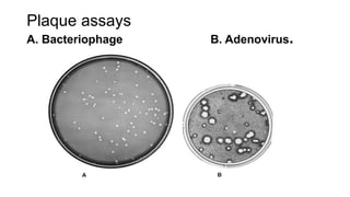 Plaque assays
A. Bacteriophage B. Adenovirus.
 