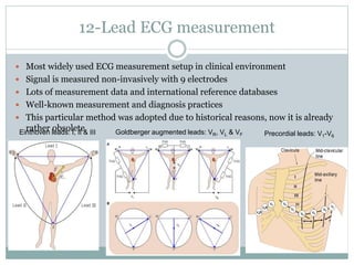12-Lead ECG measurement
 Most widely used ECG measurement setup in clinical environment
 Signal is measured non-invasively with 9 electrodes
 Lots of measurement data and international reference databases
 Well-known measurement and diagnosis practices
 This particular method was adopted due to historical reasons, now it is already
rather obsoleteEinthoven leads: I, II & III Goldberger augmented leads: VR, VL & VF Precordial leads: V1-V6
 