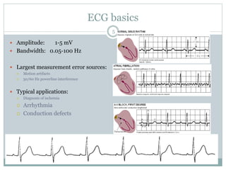 ECG basics
 Amplitude: 1-5 mV
 Bandwidth: 0.05-100 Hz
 Largest measurement error sources:
 Motion artifacts
 50/60 Hz powerline interference
 Typical applications:
 Diagnosis of ischemia
 Arrhythmia
 Conduction defects
5
 