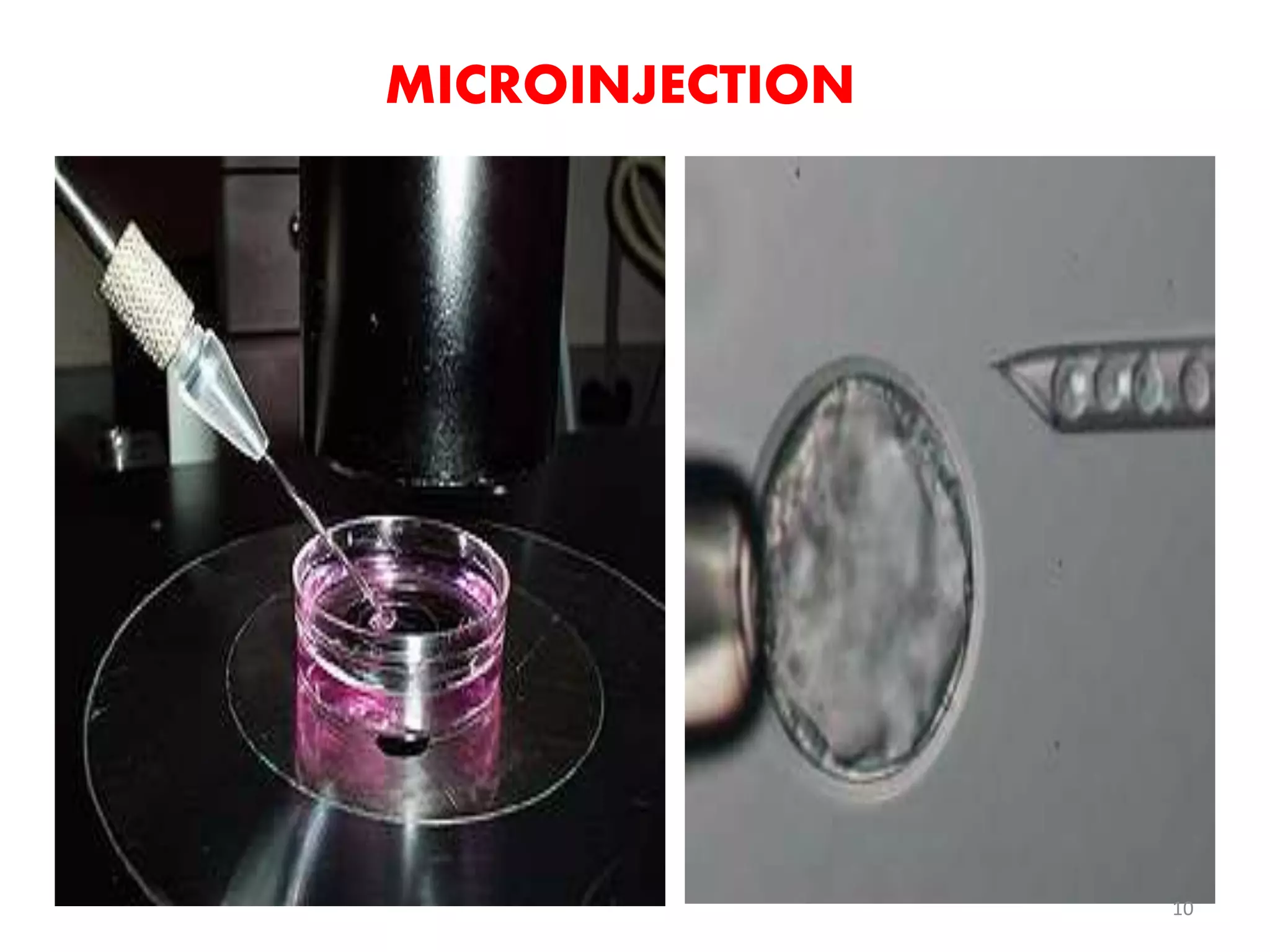 MICROINJECTION
10
 