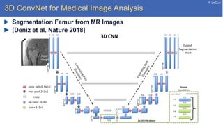 Y. LeCun
3D ConvNet for Medical Image Analysis
Segmentation Femur from MR Images
[Deniz et al. Nature 2018]
 