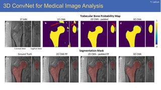 Y. LeCun
3D ConvNet for Medical Image Analysis
 