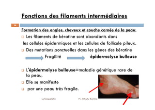 Fonctions des filaments intermédiaires
36
Formation des ongles, cheveux et couche cornée de la peau:
Les filaments de kératine sont abondants dans
les cellules épidermiques et les cellules de follicule pileux.
Des mutations ponctuelles dans les gènes des kératine
Fragilité épidermolyse bulleuse
Cytosquelette Pr. MIKOU Karima
Fragilité épidermolyse bulleuse
L'épidermolyse bulleuse=maladie génétique rare de
la peau.
Elle se manifeste
par une peau très fragile.
 