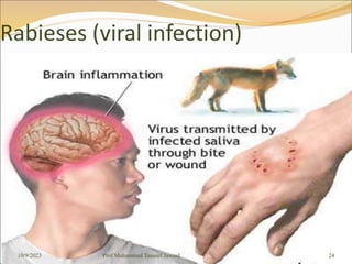 Rabieses (viral infection)
10/9/2023 24
Prof Muhammad Tauseef Jawaid
 