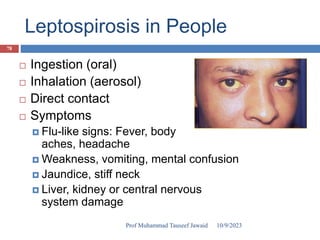 Leptospirosis in People
 Ingestion (oral)
 Inhalation (aerosol)
 Direct contact
 Symptoms
 Flu-like signs: Fever, body
aches, headache
 Weakness, vomiting, mental confusion
 Jaundice, stiff neck
 Liver, kidney or central nervous
system damage
10/9/2023
78
Prof Muhammad Tauseef Jawaid
 