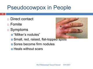 Pseudocowpox in People
 Direct contact
 Fomite
 Symptoms
 “Milker’s nodules”
 Small, red, raised, flat-topped spots
 Sores become firm nodules
 Heals without scars
10/9/2023
82
Prof Muhammad Tauseef Jawaid
 