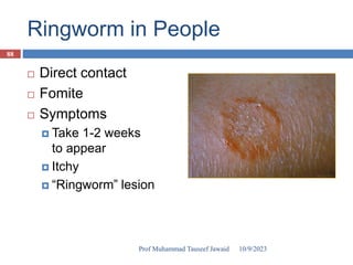 Ringworm in People
 Direct contact
 Fomite
 Symptoms
 Take 1-2 weeks
to appear
 Itchy
 “Ringworm” lesion
10/9/2023
88
Prof Muhammad Tauseef Jawaid
 